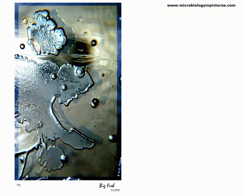 bacterial colonies